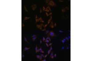 Immunofluorescence analysis of HeLa cells using UBE2L6 antibody (ABIN6134446, ABIN6149808, ABIN6149809 and ABIN6217753) at dilution of 1:100. (UBE2L6 antibody  (C-Term))