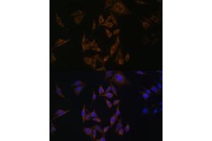 Immunofluorescence analysis of HeLa cells using UBE2L6 antibody (ABIN6134446, ABIN6149808, ABIN6149809 and ABIN6217753) at dilution of 1:100. (UBE2L6 antibody  (C-Term))
