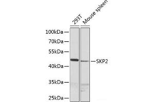 Western blot analysis of extracts of various cell lines using SKP2 Polyclonal Antibody at dilution of 1:1000. (SKP2 antibody)