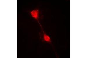 Immunofluorescent analysis of IKB alpha staining in HepG2 cells.
