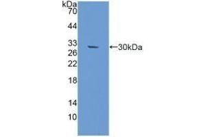 Detection of Recombinant RAD50, Mouse using Polyclonal Antibody to DNA Repair Protein RAD50 (RAD50) (RAD50 antibody  (AA 1-234))