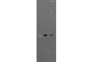 L1 Mouse liver lysates, L2 Mouse cerebrum lysates probed with Anti- EDG2/LPA1 Polyclonal Antibody, Unconjugated (ABIN681103) at 1:300 in 4 °C.