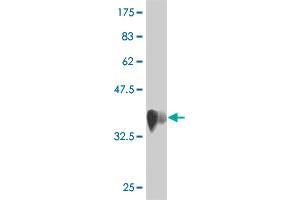 Western Blot detection against Immunogen (36. (RNFT1 antibody  (AA 1-100))