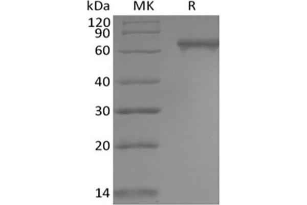 NOTCH2 Protein (His tag)