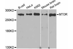 Western blot analysis of extracts of various cell lines, using MTOR antibody (ABIN5998278) at 1/1000 dilution. (MTOR antibody)