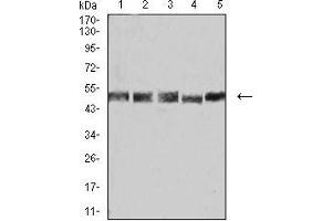 Western blot analysis using UFD1L mouse mAb against K562 (1), Hela (2), A431 (3), PC-2 (4), and A549 (5) cell lysate.