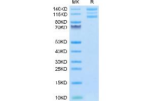 Human ITGAV&ITGB6 on Tris-Bis PAGE under reduced conditions. (ITGAV/ITGB6 Protein (AA 31-992) (His-Avi Tag))