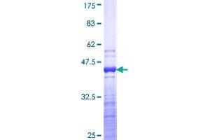 TNNT3 Protein (AA 161-258) (GST tag)