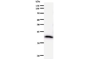 Western Blotting (WB) image for anti-DEAD (Asp-Glu-Ala-Asp) Box Polypeptide 5 (DDX5) antibody (ABIN933122) (DDX5 antibody)