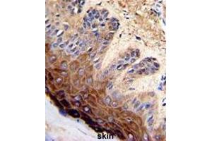Formalin-fixed and paraffin-embedded human skin with TOP2A Antibody (C-term), which was peroxidase-conjugated to the secondary antibody, followed by DAB staining. (Topoisomerase II alpha antibody  (C-Term))