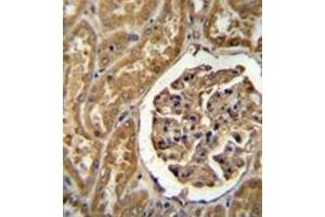 Immunohistochemistry analysis in formalin fixed and paraffin embedded human kidney tissue reacted with MOGT1 Antibody (C-term) followed by peroxidase conjugation of the secondary antibody and DAB staining. (MOGAT1 antibody  (C-Term))