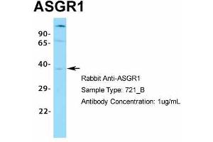Host:  Rabbit  Target Name:  ASGR1  Sample Type:  721_B  Antibody Dilution:  1. (Asialoglycoprotein Receptor 1 antibody  (N-Term))