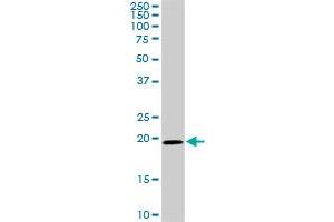 SRI monoclonal antibody (M01), clone 1E12. (SRI antibody  (AA 1-198))