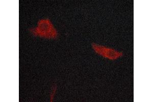 ABIN6268862 staining lovo cells by ICC/IF.