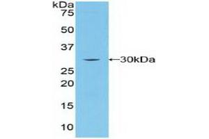 Detection of Recombinant BRCA2, Human using Polyclonal Antibody to Breast Cancer Susceptibility Protein 2 (BRCA2) (BRCA2 antibody  (AA 2308-2537))