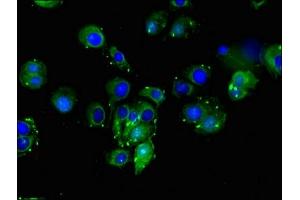 Immunofluorescent analysis of MCF-7 cells using ABIN7149653 at dilution of 1:100 and Alexa Fluor 488-congugated AffiniPure Goat Anti-Rabbit IgG(H+L) (DLL4 antibody  (AA 44-345))