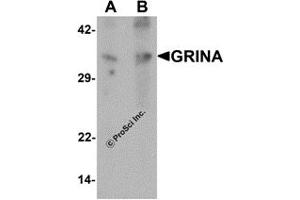 Western Blotting (WB) image for anti-Glutamate Receptor, Ionotropic, N-Methyl D-Aspartate-Associated Protein 1 (Glutamate Binding) (GRINA) antibody (ABIN1077413) (GRINA antibody)