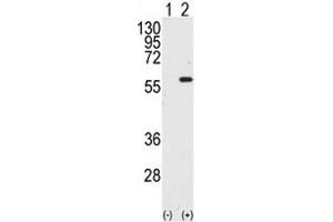 Western blot analysis of STK4 / MST1 antibody and 293 cell lysate either nontransfected (Lane 1) or transiently transfected with the STK4 gene (2). (STK4 antibody  (AA 385-415))