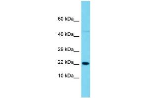 Host: Rabbit  Target Name: Snx12  Sample Tissue: Rat Pancreas lysates  Antibody Dilution: 1. (SNX12 antibody  (C-Term))