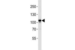 MERTK antibody