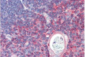 ABIN570663 (5µg/ml) staining of paraffin embedded Human Thymus. (TXK antibody  (C-Term))