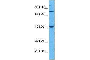 Western Blotting (WB) image for anti-Forkhead Box M1 (FOXM1) (Middle Region) antibody (ABIN2792172)
