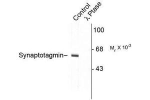Image no. 1 for anti-Synaptotagmin I (SYT1) (pThr202) antibody (ABIN372724) (SYT1 antibody  (pThr202))