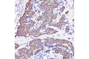 Immunohistochemistry of paraffin-embedded rat testis using UBL3 antibody (ABIN6131930, ABIN6149849, ABIN6149850 and ABIN6220468) at dilution of 1:100 (40x lens). (UBL3 antibody  (AA 1-117))