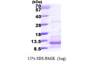 SDS-PAGE (SDS) image for Chemokine (C-C Motif) Ligand 20 (CCL20) (AA 27-96) protein (His tag) (ABIN667875)