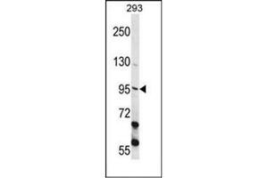 Western Blotting (WB) image for anti-Epithelial Cell Transforming Sequence 2 Oncogene (ECT2) (AA 565-594), (Middle Region) antibody (ABIN952020)