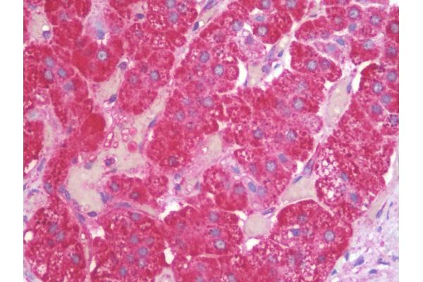 ZNF821 antibody  (C-Term)