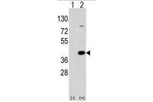 Image no. 1 for anti-Epilepsy, Progressive Myoclonus Type 2A, Lafora Disease (Laforin) (EPM2A) (C-Term) antibody (ABIN356954) (EPM2A antibody  (C-Term))