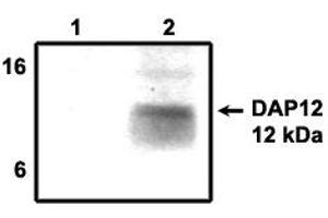 Image no. 1 for anti-TYRO Protein tyrosine Kinase Binding Protein (TYROBP) antibody (ABIN201720)