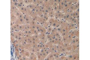 IHC-P analysis of liver tissue, with DAB staining. (Factor VIII antibody  (AA 2253-2346))