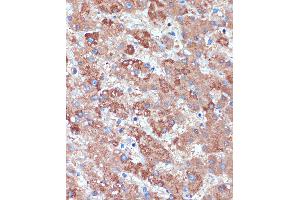 Immunohistochemistry of paraffin-embedded Human liver using B3GNT3 Rabbit pAb (ABIN7271204) at dilution of 1:100 (40x lens). (B3GNT3 antibody  (AA 120-240))