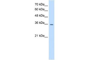 TRPM5 antibody used at 0. (TRPM5 antibody  (N-Term))