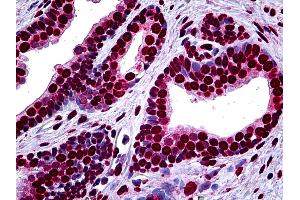 Anti-MEF2A antibody IHC of human prostate. (MEF2A antibody  (AA 71-170))