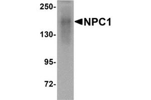 Western Blotting (WB) image for anti-Niemann-Pick Disease, Type C1 (NPC1) (C-Term) antibody (ABIN1030549) (NPC1 antibody  (C-Term))