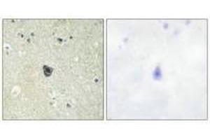Immunohistochemistry analysis of paraffin-embedded human brain tissue using CSFR (Ab-809) antibody. (CSF1R antibody  (Tyr809))