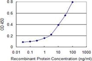 Detection limit for recombinant GST tagged ULK2 is 0. (ULK2 antibody  (AA 743-843))