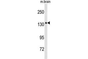 Western blot analysis of UTY Antibody (C-term) in mouse brain tissue lysates (35 µg/lane). (UTY antibody  (C-Term))