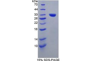 Image no. 1 for Contactin Associated Protein 1 (CNTNAP1) (AA 673-918) protein (His tag) (ABIN4988583) (CNTNAP1 Protein (AA 673-918) (His tag))