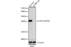 Western blot analysis of extracts from normal (control) and HSP27/HSP27/HSPB1 knockout (KO) HeLa cells, using HSP27/HSP27/HSPB1 antibody (ABIN7267568) at 1:1000 dilution. (HSP27 antibody  (AA 1-120))
