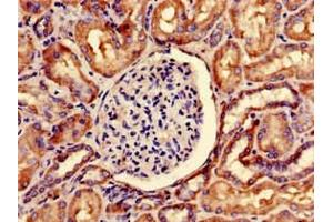 Immunohistochemistry of paraffin-embedded human kidney tissue using ABIN7169873 at dilution of 1:100 (SNRPD1 antibody  (AA 1-119))