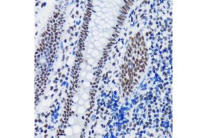 Immunohistochemistry of paraffin-embedded human appendix using SF3B1 Rabbit mAb (ABIN7270542) at dilution of 1:100 (40x lens).