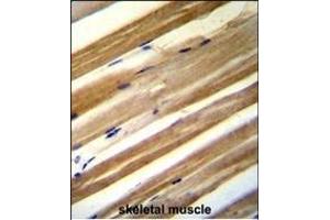 C antibody (C-term) (ABIN654725 and ABIN2844413) immunohistochemistry analysis in formalin fixed and paraffin embedded human skeletal muscle followed by peroxidase conjugation of the secondary antibody and DAB staining. (CU070 Protein antibody  (C-Term))