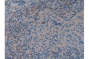 Immunohistochemistry (IHC) image for anti-Wingless-Type MMTV Integration Site Family, Member 3A (WNT3A) (AA 1-290) antibody (ABIN7430189)