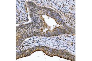 IHC analysis of THAP11 using anti-THAP11 antibody (ABIN7599230). (THAP11 antibody  (AA 1-294))