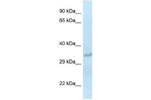 Western Blot showing Sult1c2 antibody used at a concentration of 1. (SULT1C2 antibody  (Middle Region))
