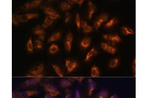 Immunofluorescence analysis of U-2 OS cells using SSTR2 Polyclonal Antibody at dilution of 1:100 (40x lens). (SSTR2 antibody)
